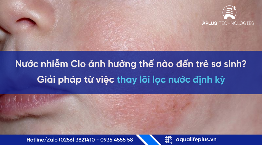 Nước nhiễm Clo ảnh hưởng đến trẻ sơ sinh | Giải pháp lọc nước an toàn từ Aplus Technologies